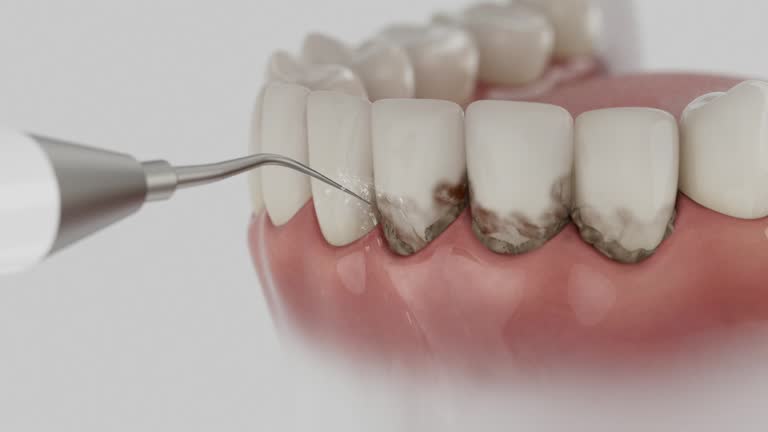 Reliable Dental contractor in Hudson Lake, IN by Dentist Open Now